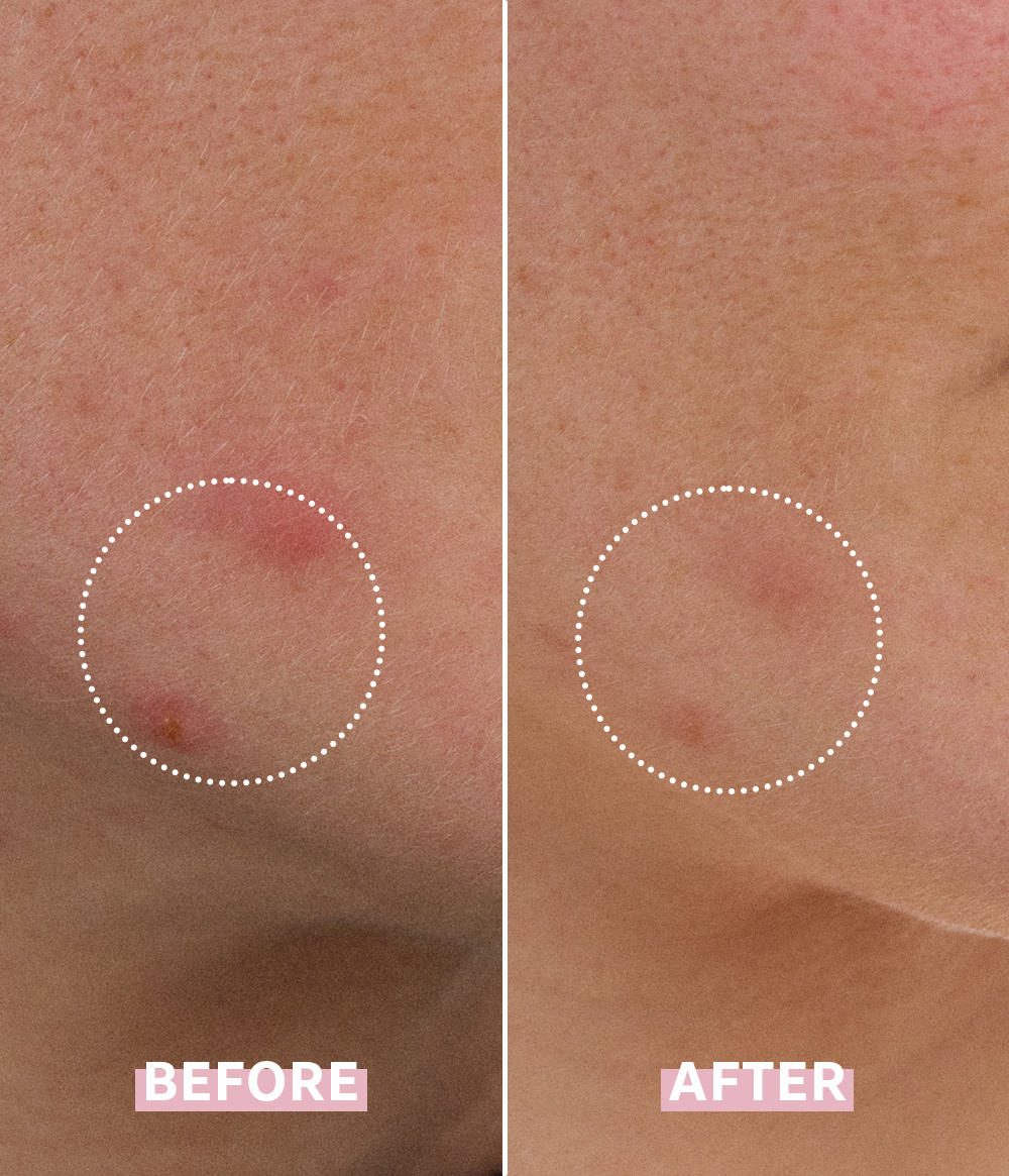 OH MY CICA SPOT GEL CREAM OH MY CICA SPOT GEL CREAM